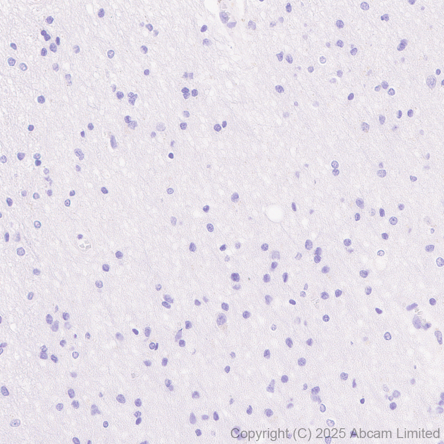 Immunohistochemistry (Formalin/PFA-fixed paraffin-embedded sections) - Anti-STEAP1 antibody [EPR29701-75] (AB324263), expandable thumbnail