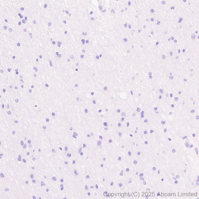 Immunohistochemistry (Formalin/PFA-fixed paraffin-embedded sections) - Anti-STEAP1 antibody [EPR29701-75] (AB324263)