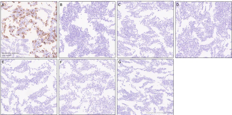 Immunohistochemistry (Formalin/PFA-fixed paraffin-embedded sections) - Anti-STEAP1 antibody [EPR29701-75] (AB324263)