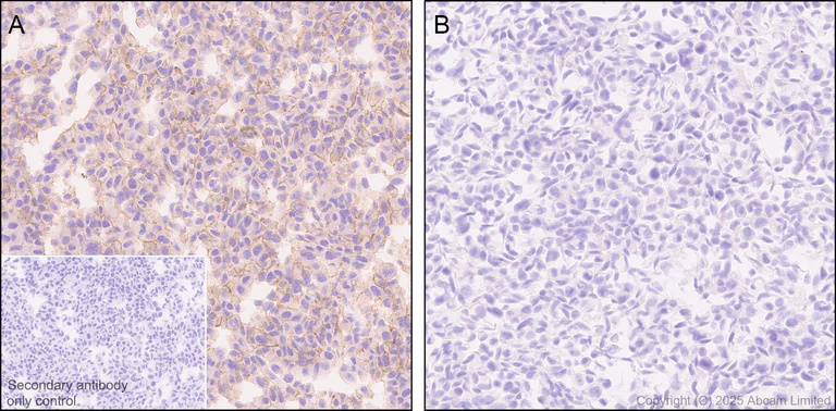 Immunohistochemistry (Formalin/PFA-fixed paraffin-embedded sections) - Anti-STEAP1 antibody [EPR29701-75] - BSA and Azide free (AB325969)