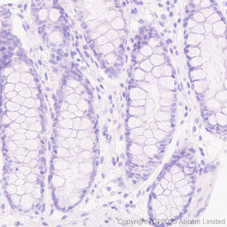 Immunohistochemistry (Formalin/PFA-fixed paraffin-embedded sections) - Anti-STEAP1 antibody [EPR29701-75] - BSA and Azide free (AB325969)