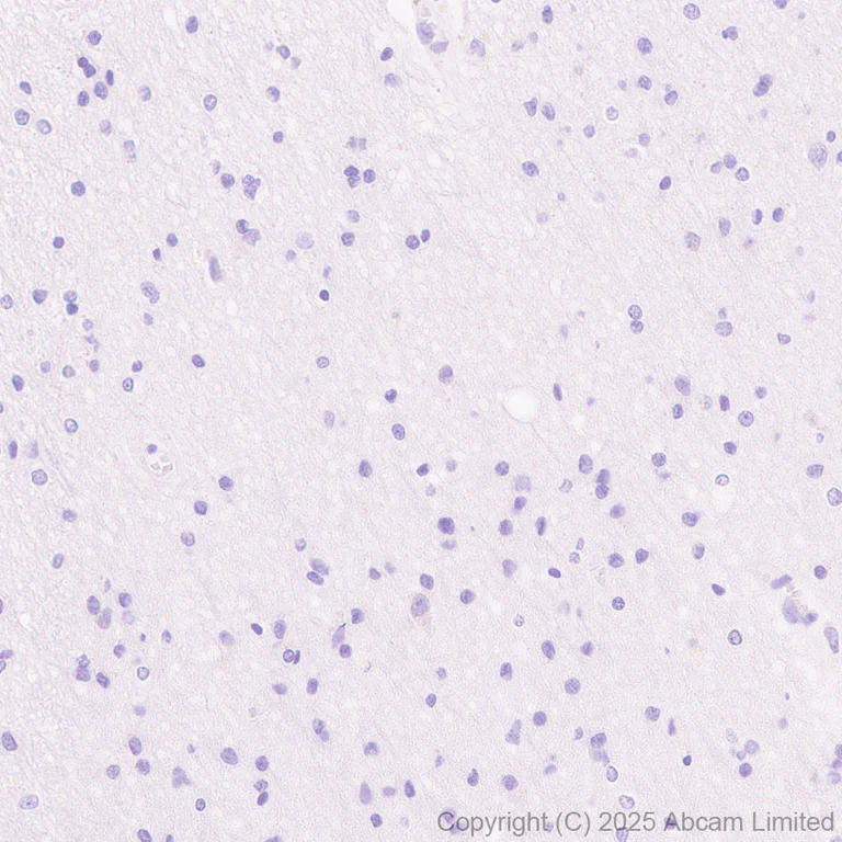 Immunohistochemistry (Formalin/PFA-fixed paraffin-embedded sections) - Anti-STEAP1 antibody [EPR29701-75] - BSA and Azide free (AB325969)
