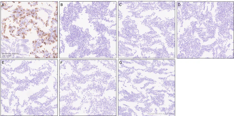 Immunohistochemistry (Formalin/PFA-fixed paraffin-embedded sections) - Anti-STEAP1 antibody [EPR29701-75] - BSA and Azide free (AB325969)