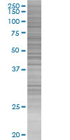 STEAP1 overexpression 293T lysate (whole cell)