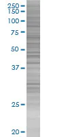 SDS-PAGE - STEAP1 overexpression 293T lysate (whole cell) (AB94255)