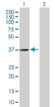 Western blot - STEAP1 overexpression 293T lysate (whole cell) (AB94255)