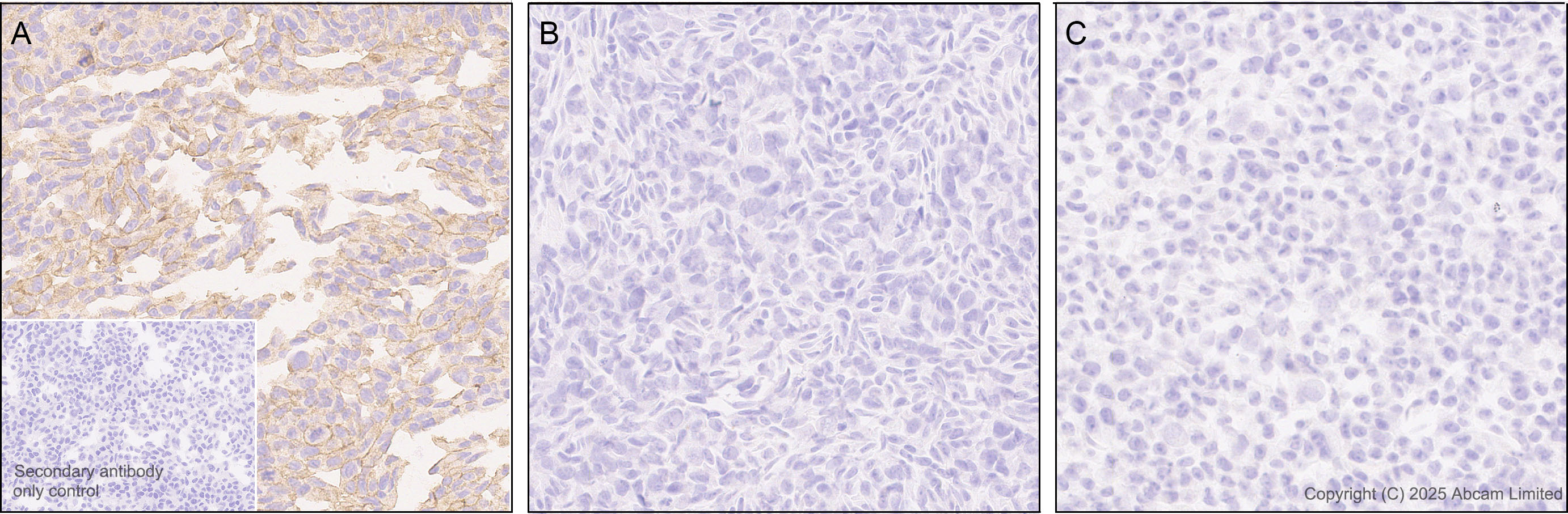 Immunohistochemistry (Formalin/PFA-fixed paraffin-embedded sections) - Anti-STEAP2 antibody [EPR30542-566] (AB324346), expandable thumbnail