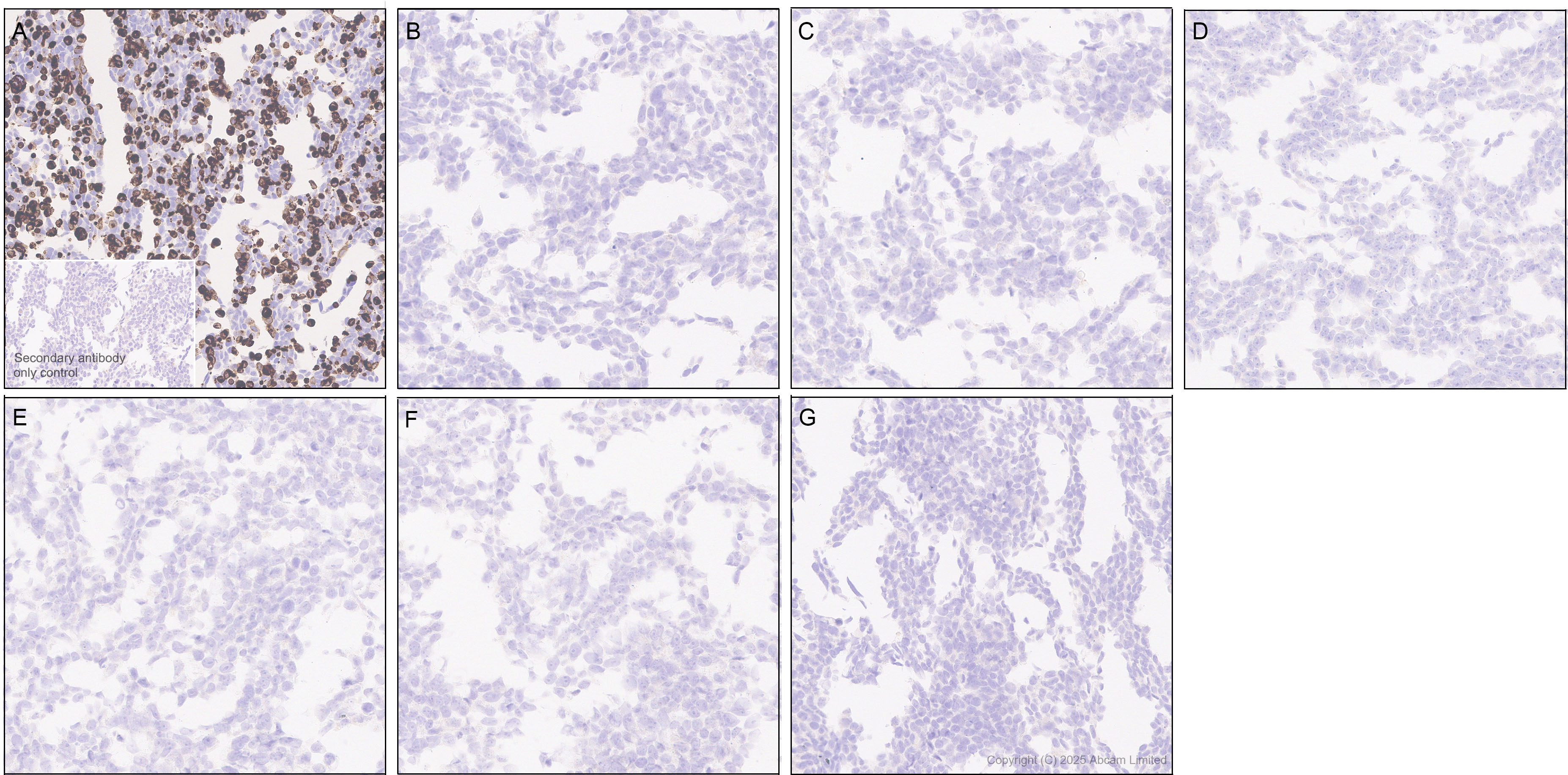 Immunohistochemistry (Formalin/PFA-fixed paraffin-embedded sections) - Anti-STEAP2 antibody [EPR30542-566] (AB324346), expandable thumbnail