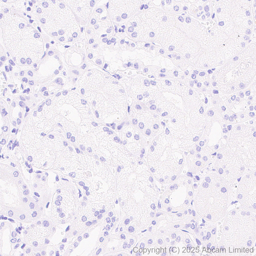 Immunohistochemistry (Formalin/PFA-fixed paraffin-embedded sections) - Anti-STEAP2 antibody [EPR30542-566] (AB324346), expandable thumbnail