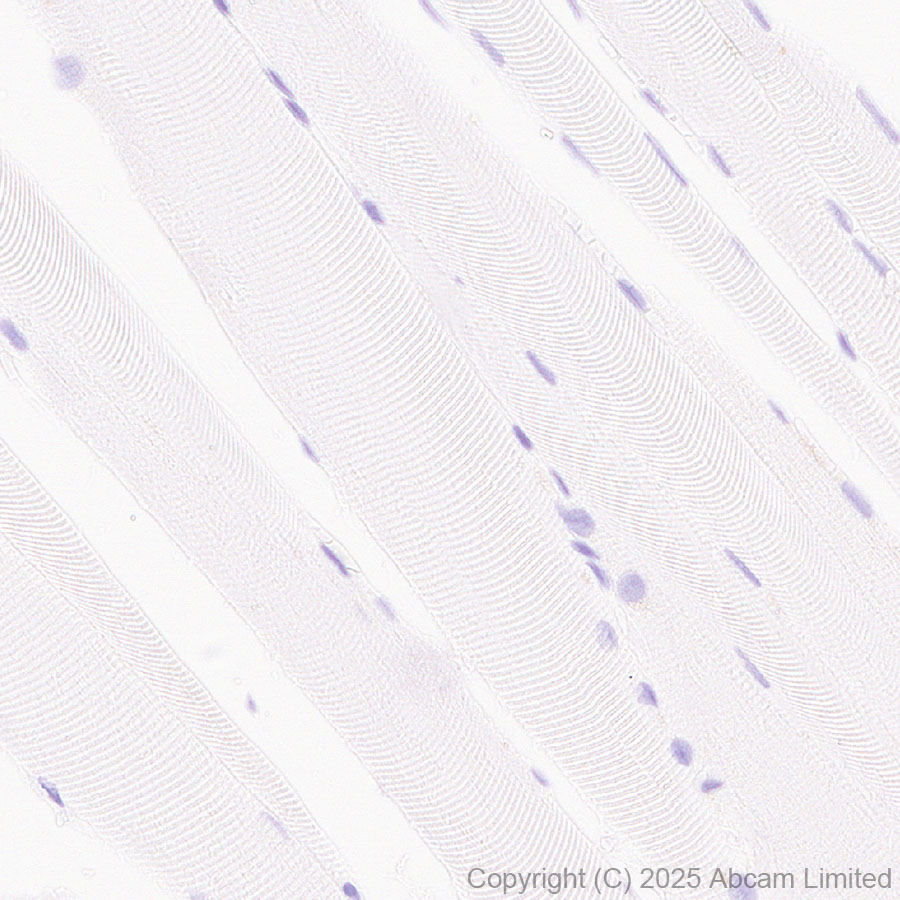 Immunohistochemistry (Formalin/PFA-fixed paraffin-embedded sections) - Anti-STEAP2 antibody [EPR30542-566] (AB324346), expandable thumbnail