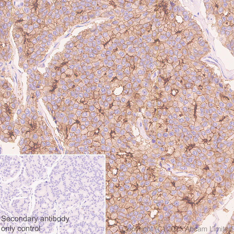 Immunohistochemistry (Formalin/PFA-fixed paraffin-embedded sections) - Anti-STEAP2 antibody [EPR30542-566] - BSA and Azide free (AB324357)