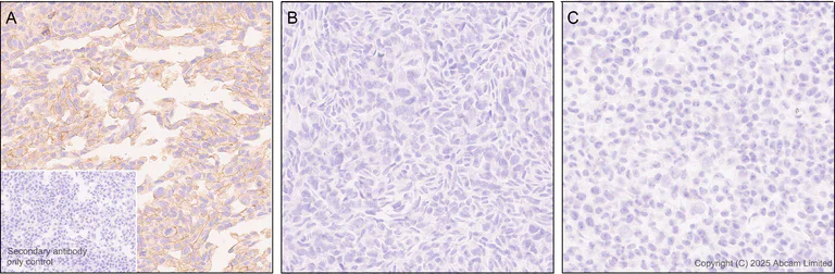 Immunohistochemistry (Formalin/PFA-fixed paraffin-embedded sections) - Anti-STEAP2 antibody [EPR30542-566] - BSA and Azide free (AB324357)