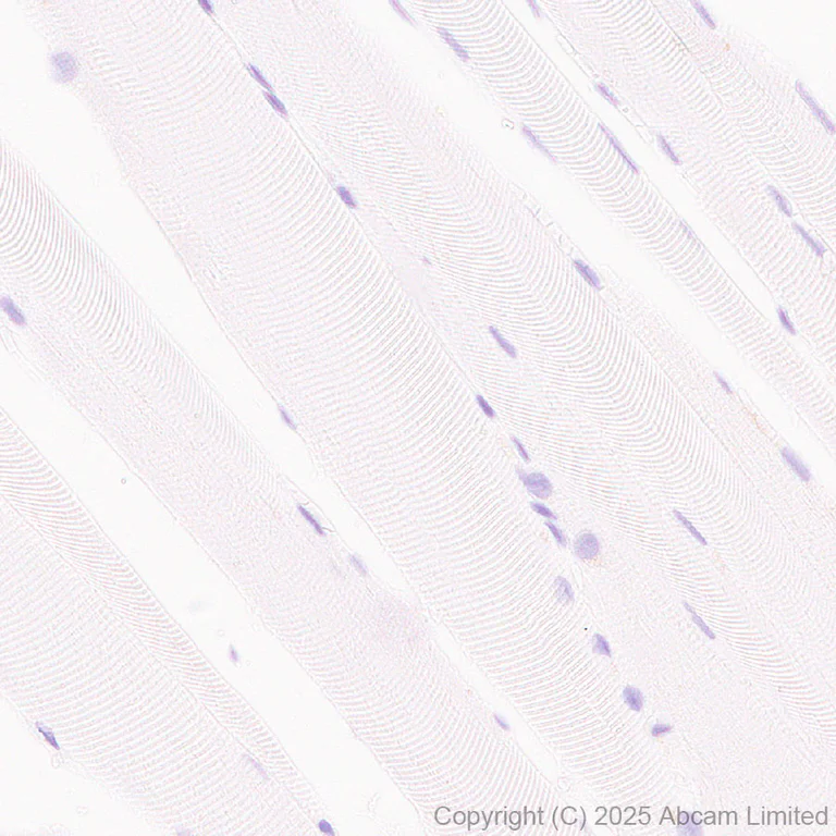 Immunohistochemistry (Formalin/PFA-fixed paraffin-embedded sections) - Anti-STEAP2 antibody [EPR30542-566] - BSA and Azide free (AB324357)