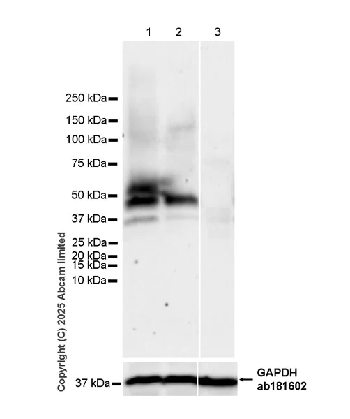 Western blot - Anti-STEAP3 antibody [EPR30543-594] (AB324564)