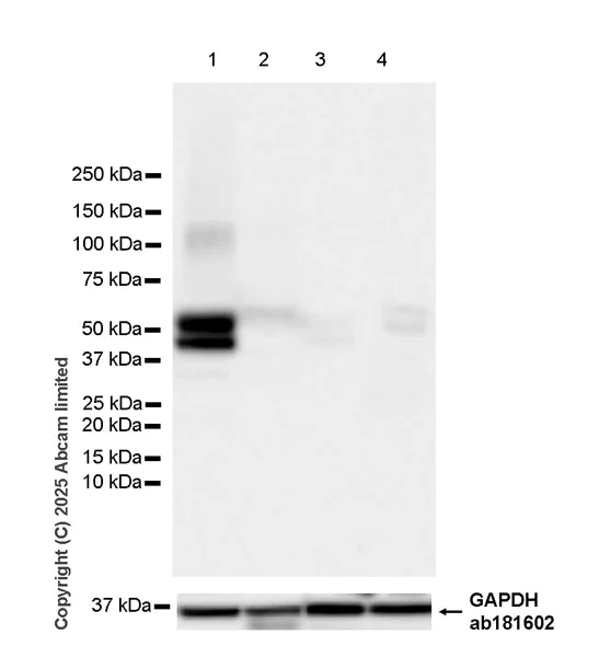 Western blot - Anti-STEAP3 antibody [EPR30543-594] (AB324564)