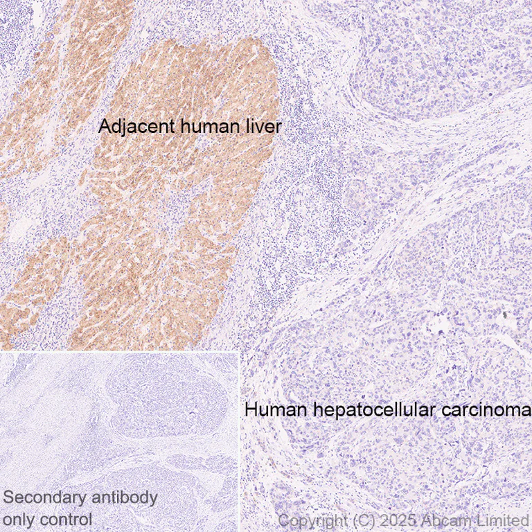 Immunohistochemistry (Formalin/PFA-fixed paraffin-embedded sections) - Anti-STEAP3 antibody [EPR30543-594] - BSA and Azide free (AB324571)
