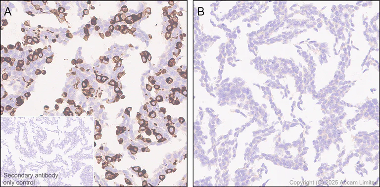 Immunohistochemistry (Formalin/PFA-fixed paraffin-embedded sections) - Anti-STEAP3 antibody [EPR30543-594] - BSA and Azide free (AB324571)