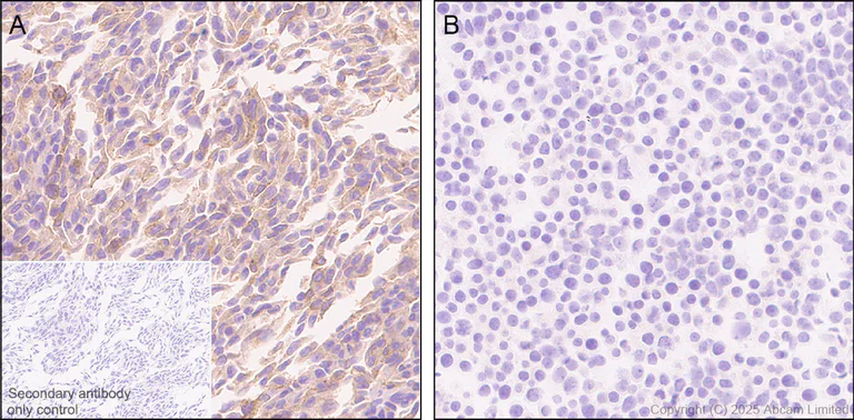 Immunohistochemistry (Formalin/PFA-fixed paraffin-embedded sections) - Anti-STEAP3 antibody [EPR30543-594] - BSA and Azide free (AB324571)