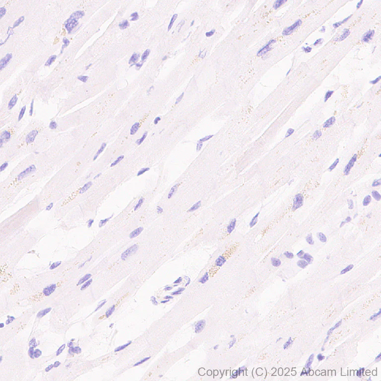 Immunohistochemistry (Formalin/PFA-fixed paraffin-embedded sections) - Anti-STEAP3 antibody [EPR30543-594] - BSA and Azide free (AB324571)
