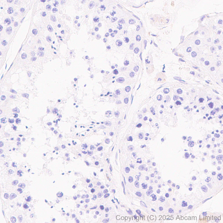 Immunohistochemistry (Formalin/PFA-fixed paraffin-embedded sections) - Anti-STEAP3 antibody [EPR30543-594] - BSA and Azide free (AB324571)
