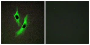 Immunocytochemistry/ Immunofluorescence - Anti-STEAP4 antibody (AB113230)