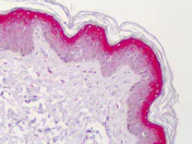 Immunohistochemistry (Formalin/PFA-fixed paraffin-embedded sections) - Anti-STEAP4 antibody (AB113230)