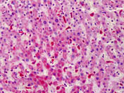 Immunohistochemistry (Formalin/PFA-fixed paraffin-embedded sections) - Anti-STEAP4 antibody (AB113230)