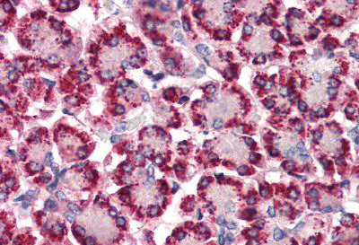 Immunohistochemistry (Formalin/PFA-fixed paraffin-embedded sections) - Anti-STEAP4 antibody - N-terminal (AB140951)