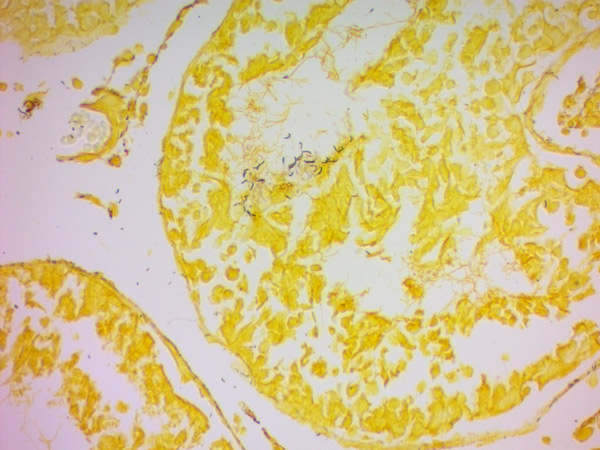 Immunohistochemistry (Formalin/PFA-fixed paraffin-embedded sections) - Steiner Stain Kit (Microorganism Stain) (AB150685), expandable thumbnail