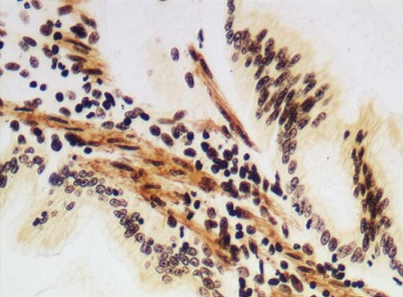 Immunohistochemistry (Formalin/PFA-fixed paraffin-embedded sections) - Steiner Stain Kit (Microorganism Stain) (AB150685), expandable thumbnail