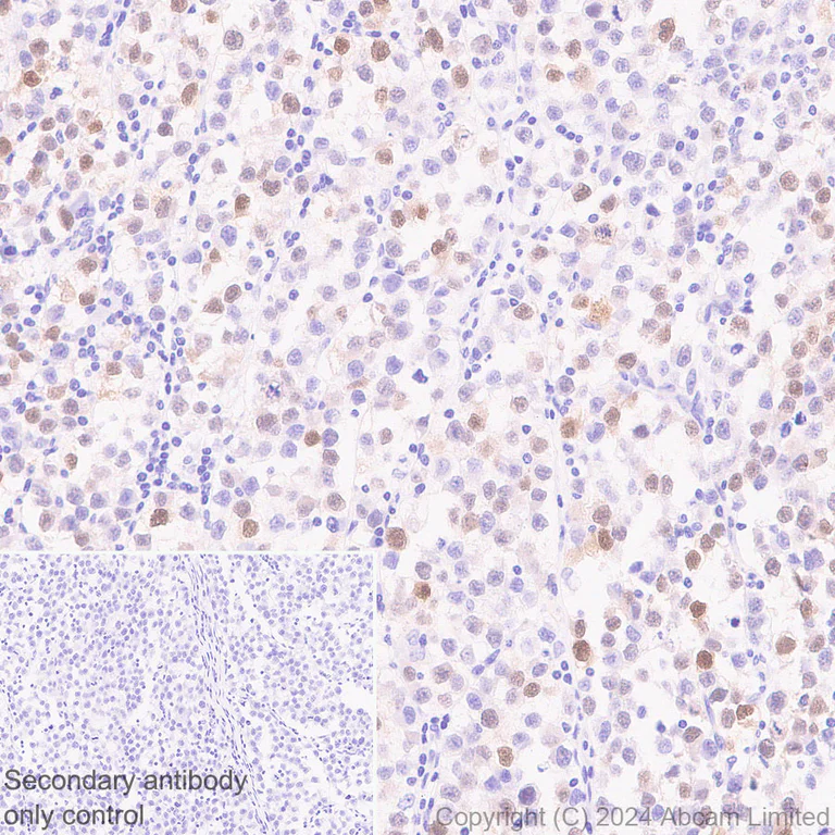 Immunohistochemistry (Formalin/PFA-fixed paraffin-embedded sections) - Anti-STELLAR antibody [EPR29225-183] - BSA and Azide free (AB324836)
