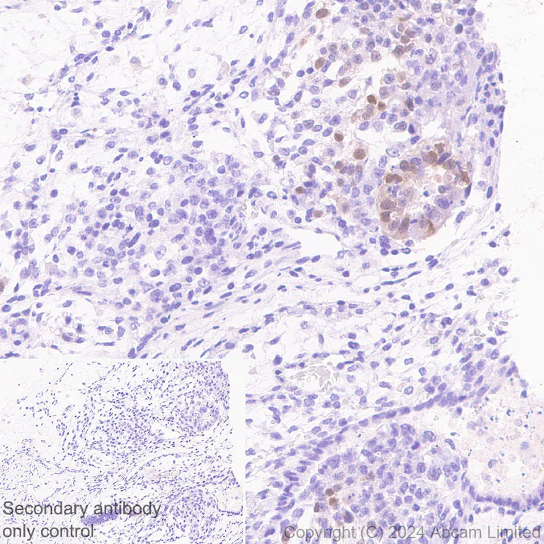 Immunohistochemistry (Formalin/PFA-fixed paraffin-embedded sections) - Anti-STELLAR antibody [EPR29225-183] - BSA and Azide free (AB324836)