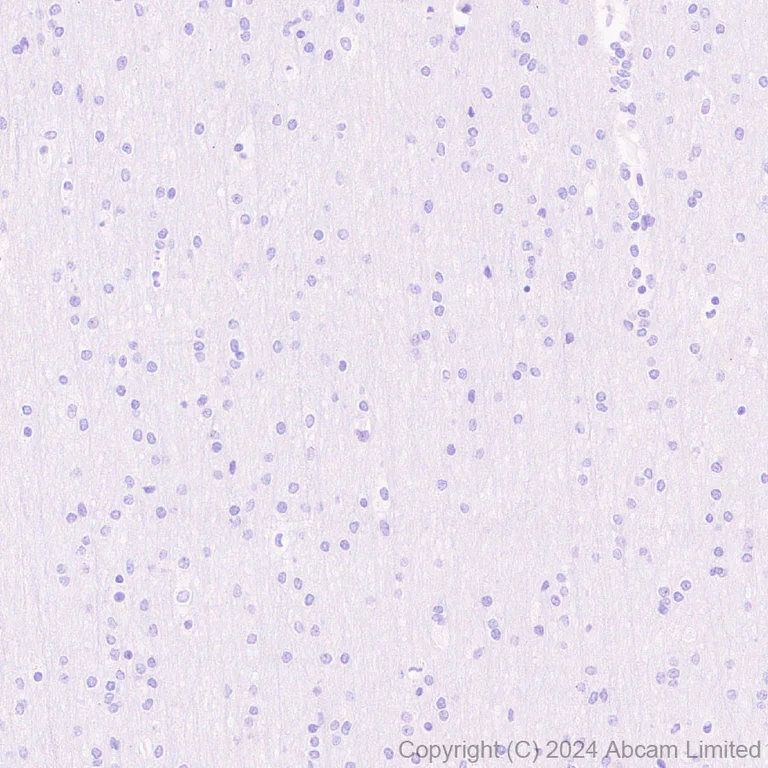 Immunohistochemistry (Formalin/PFA-fixed paraffin-embedded sections) - Anti-STELLAR antibody [EPR29225-183] - BSA and Azide free (AB324836)
