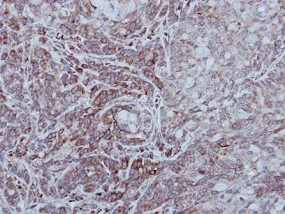 Immunohistochemistry (Formalin/PFA-fixed paraffin-embedded sections) - Anti-STEP / PTPN5 antibody (AB155329)