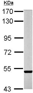 Western blot - Anti-STEP / PTPN5 antibody (AB155329)