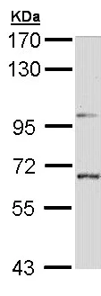 Western blot - Anti-STEP / PTPN5 antibody (AB155329)