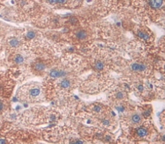 Immunohistochemistry (Formalin/PFA-fixed paraffin-embedded sections) - Anti-Steroid sulfatase antibody (AB233233)