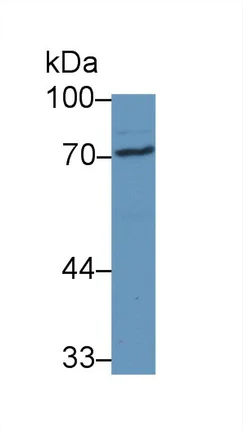Western blot - Anti-Steroid sulfatase antibody (AB233233)