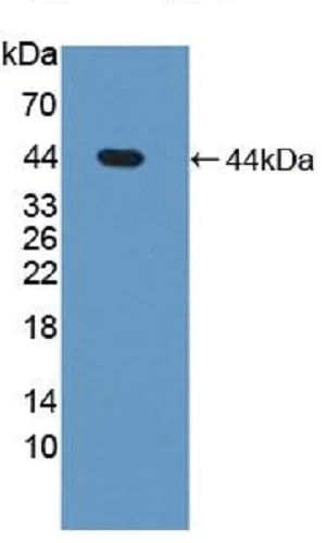 Western blot - Anti-Steroid sulfatase antibody (AB233233)