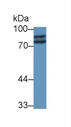 Western blot - Anti-Steroid sulfatase antibody (AB233233)
