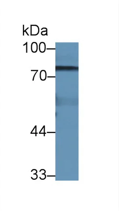 Western blot - Anti-Steroid sulfatase antibody (AB233233)
