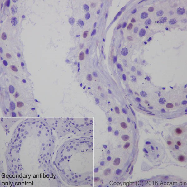 Immunohistochemistry (Formalin/PFA-fixed paraffin-embedded sections) - Anti-Steroidogenic Factor 1/SF-1 antibody [EPR19744] (AB217317), expandable thumbnail