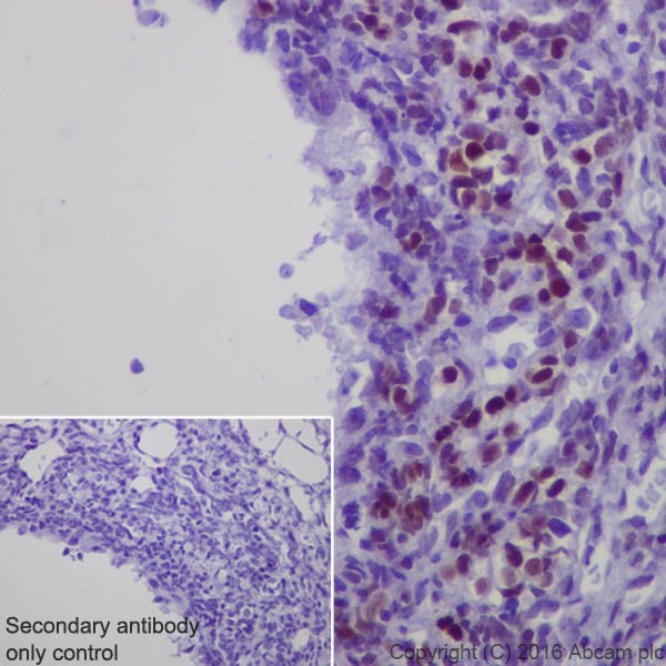 Immunohistochemistry (Formalin/PFA-fixed paraffin-embedded sections) - Anti-Steroidogenic Factor 1/SF-1 antibody [EPR19744] (AB217317), expandable thumbnail
