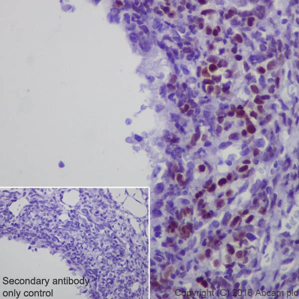 Immunohistochemistry (Formalin/PFA-fixed paraffin-embedded sections) - Anti-Steroidogenic Factor 1/SF-1 antibody [EPR19744] (AB217317)