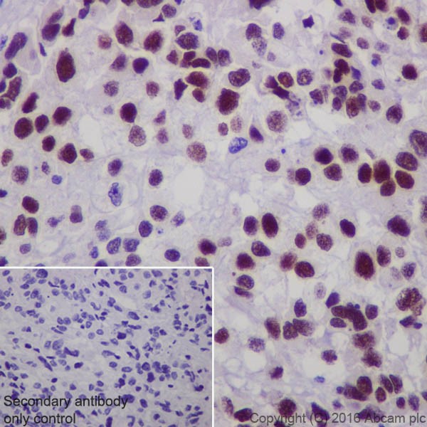Immunohistochemistry (Formalin/PFA-fixed paraffin-embedded sections) - Anti-Steroidogenic Factor 1/SF-1 antibody [EPR19744] (AB217317), expandable thumbnail