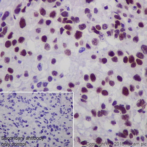 Immunohistochemistry (Formalin/PFA-fixed paraffin-embedded sections) - Anti-Steroidogenic Factor 1/SF-1 antibody [EPR19744] - BSA and Azide free (AB240394)