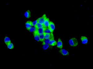 Immunocytochemistry/ Immunofluorescence - Anti-Sterol carrier protein 2 antibody [EPR9022] (AB140126)
