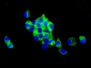 Immunocytochemistry/ Immunofluorescence - Anti-Sterol carrier protein 2 antibody [EPR9022] - BSA and Azide free (AB248889)