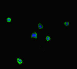 Immunocytochemistry/ Immunofluorescence - Anti-STIL/SIL antibody (AB222838), expandable thumbnail