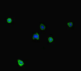 Immunocytochemistry/ Immunofluorescence - Anti-STIL/SIL antibody (AB222838)